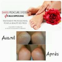 soin calluspeeling pour les pieds secs, crevasses sur les talons marseille 13008
